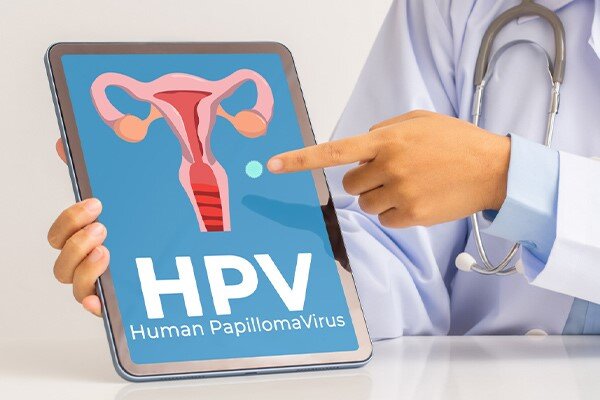 چالشهای دسترسی به واکسن HPV در ایران؛ از تحریم تا بازار سیاه/ عرضه واکسنهای تقلبی با لیبلهای جعلی وزارت بهداشت